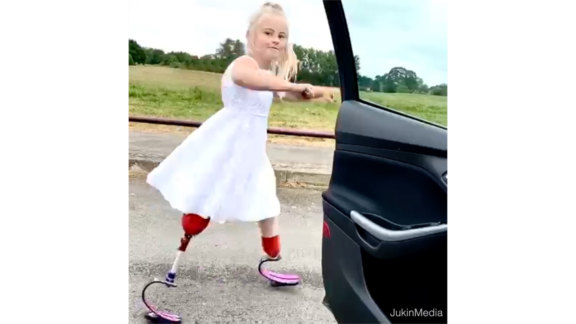 Girl With Prosthetic Legs Dances Alongside Moving Car		