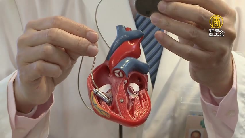 無導線心臟節律器 解決國中生心搏過緩疾病