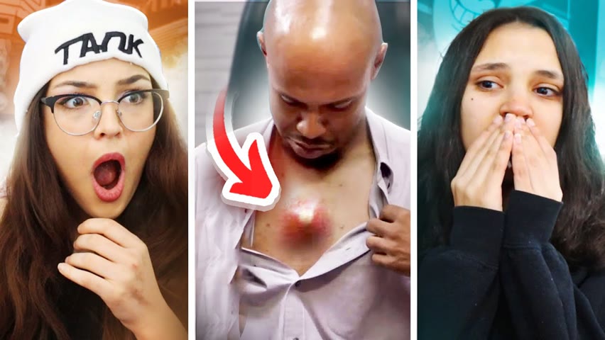 TWINS REACTING TO DISGUSTING PIMPLE POPS