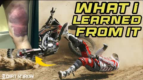 My worst dirt bike crash - Lesson learned!