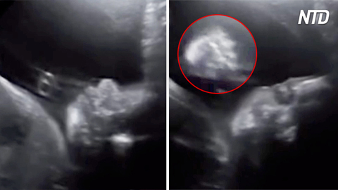 Incredible Moment When Unborn Baby Waves At Parents 자막