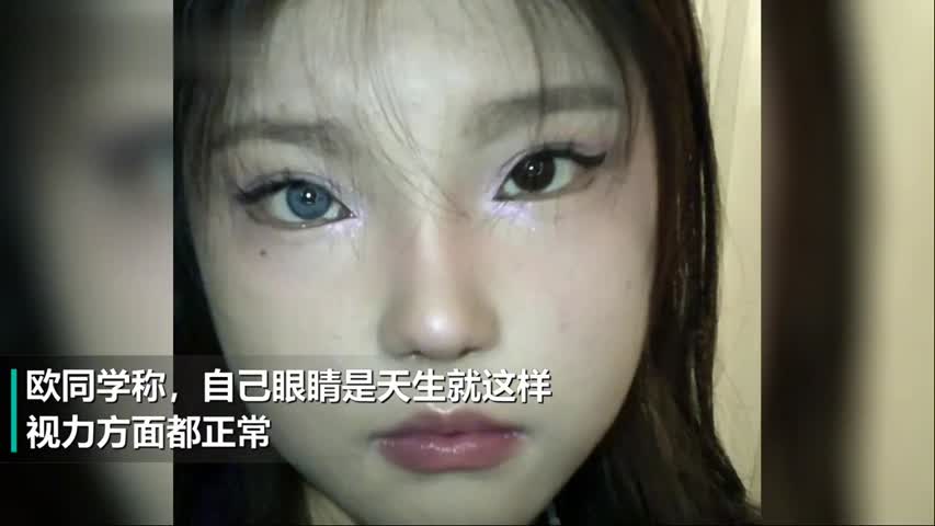 湖南长沙18岁的女生欧同學，天生一只眼睛是蓝色，引网友关注。