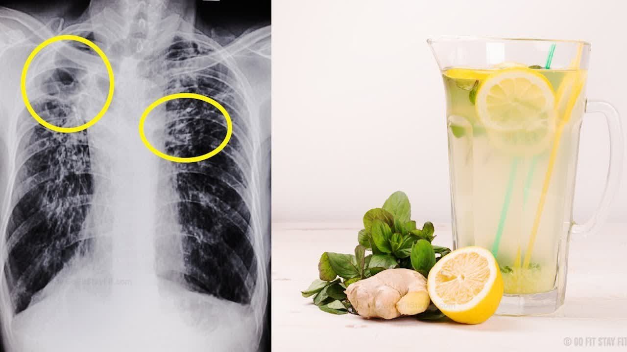 5 Remedies That Remove Phlegm & Mucus Fast - Really Effective way to Remove Phlegm & Mucus Fast