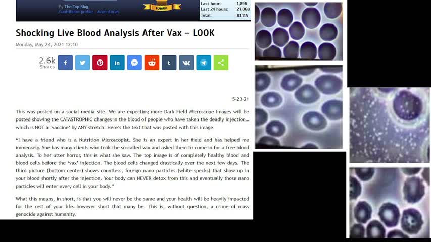 Shocking Live Blood Analysis After Vax [Audio Version]