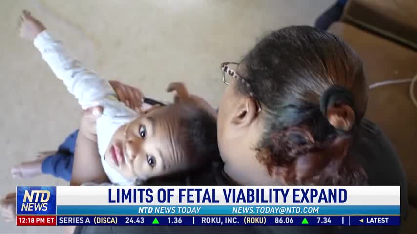 Limits of Fetal Viability Expand