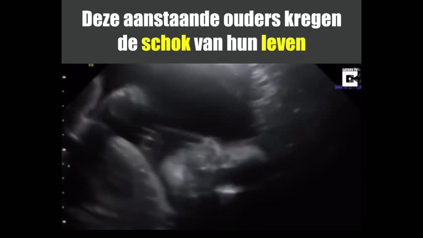 Ouders geschokt wanneer hun ongeboren baby tijdens een 4D echo naar hun kijkt.