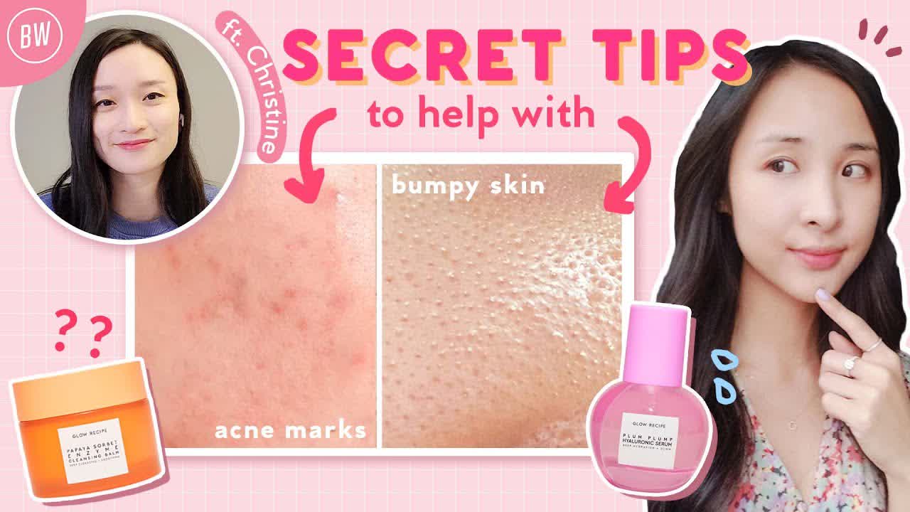 How to Improve Your Routine to Reduce Acne, Hyperpigmentation & Skin Texture ft. Glow Recipe