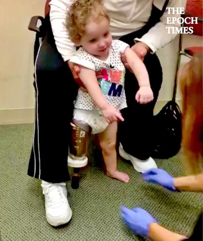 20-Month-Old Girl Takes First Steps With Prosthetic Leg