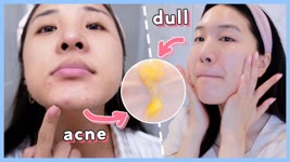 🥰 Our Weekend Skincare Routine for Oily, Acne & Dry Skin ft. Saturday Skin