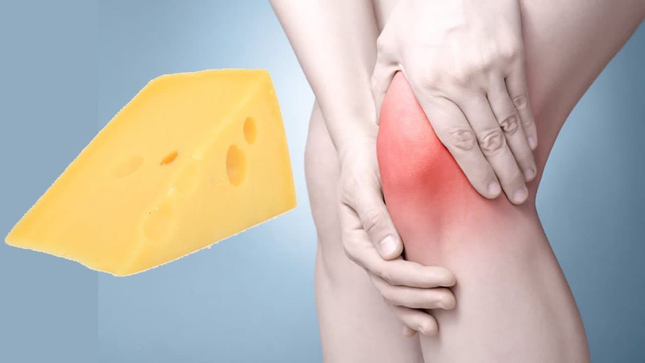 9 Worst Foods With Arthritis