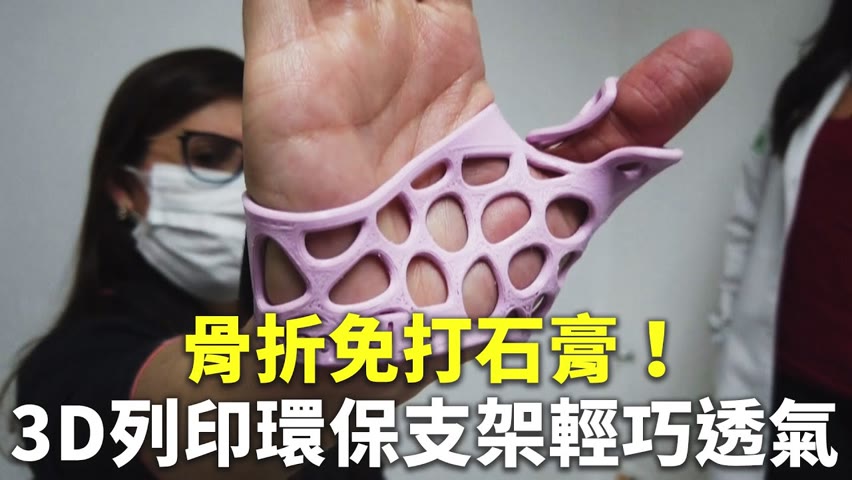 骨折免打石膏！3D列印環保支架輕巧透氣 - 醫療用品 - 新唐人亞太電視台