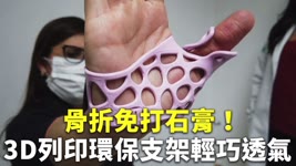 骨折免打石膏！3D列印環保支架輕巧透氣 - 醫療用品 - 新唐人亞太電視台