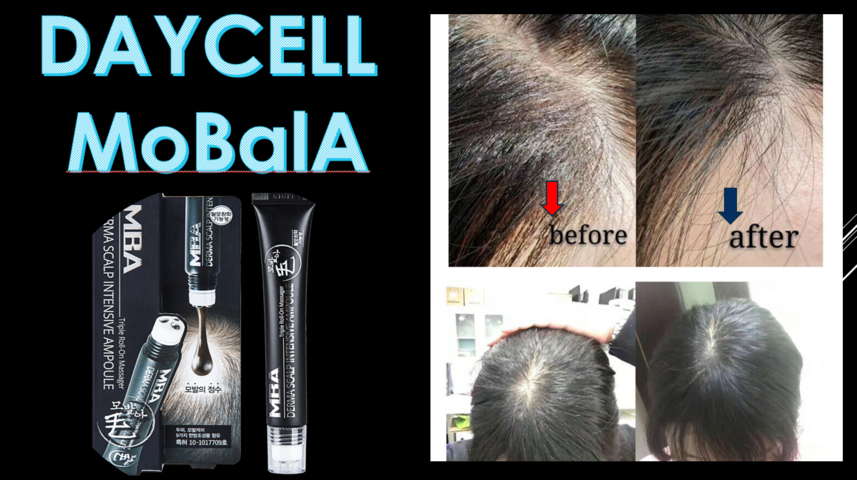 Korean Natural Hair Loss Prevention & Scalp Health Care-  DAYCELL MOBALA