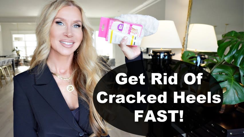 How To Get Rid Of Cracked Heels FAST!