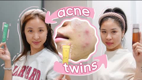 Our HORMONAL ACNE morning routine (+ she steals my skincare)