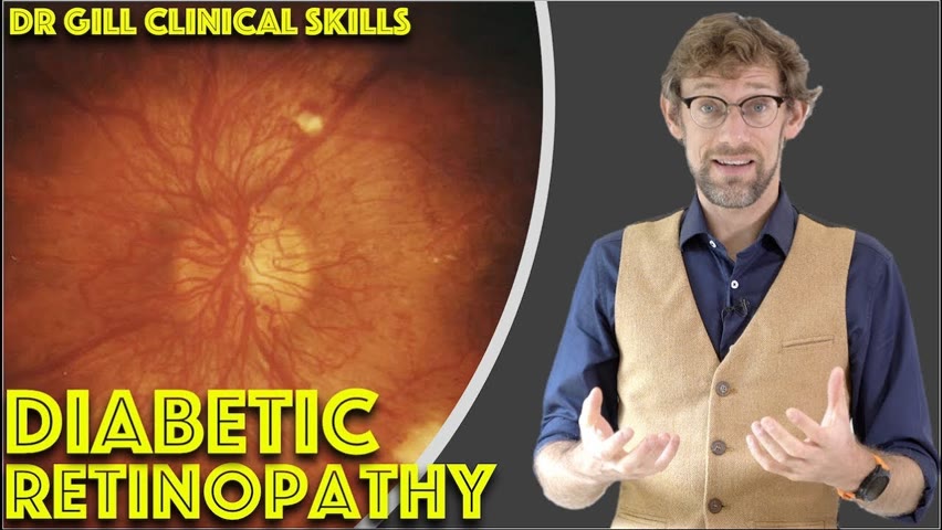 Diabetic Retinopathy - Using an Ophthalmoscope - Clinical Skills - Dr Gill