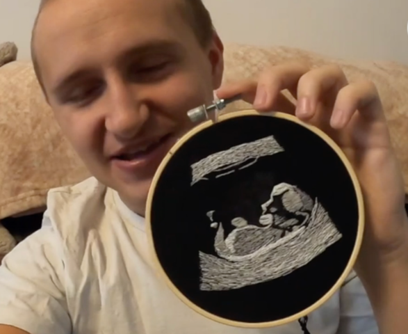 Blind Dad-to-be Receives a Tactile Embroidered Image of His Unborn Baby