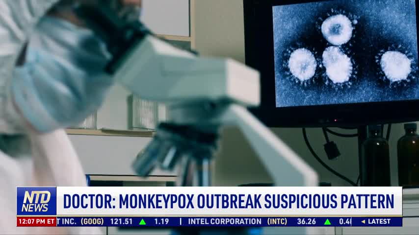 Doctor Warns of Suspicious Pattern Behind Monkeypox Outbreak