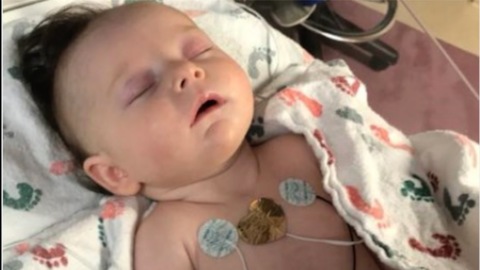 Baby Hit by Softball Opening Eyes, Moving Legs