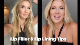 Watch This Before You Get Lip Filler | Lip Lining Techniques & Tips