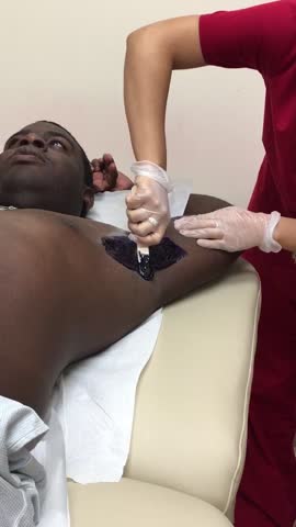 Man Gets Nervous During Armpit Waxing	