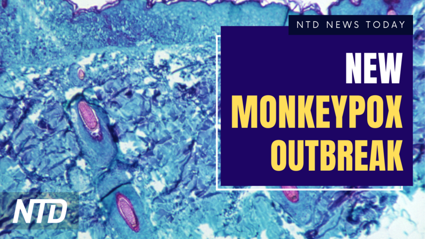 New Cases of Monkeypox Discovered; Southern Border Braces for End of Title 42 | NTD News Today